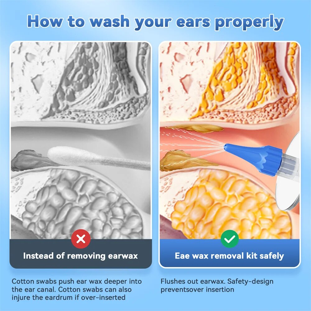 Ear Wax Removal Manual Ear Cle - Waxing Kit Home avis et prix